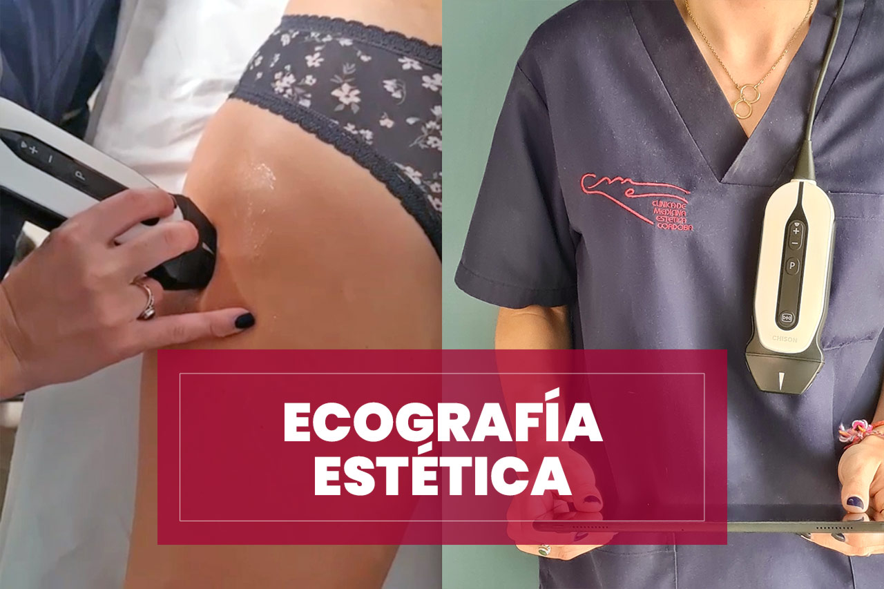 ecografia-estetica-doppler Ecografía estética