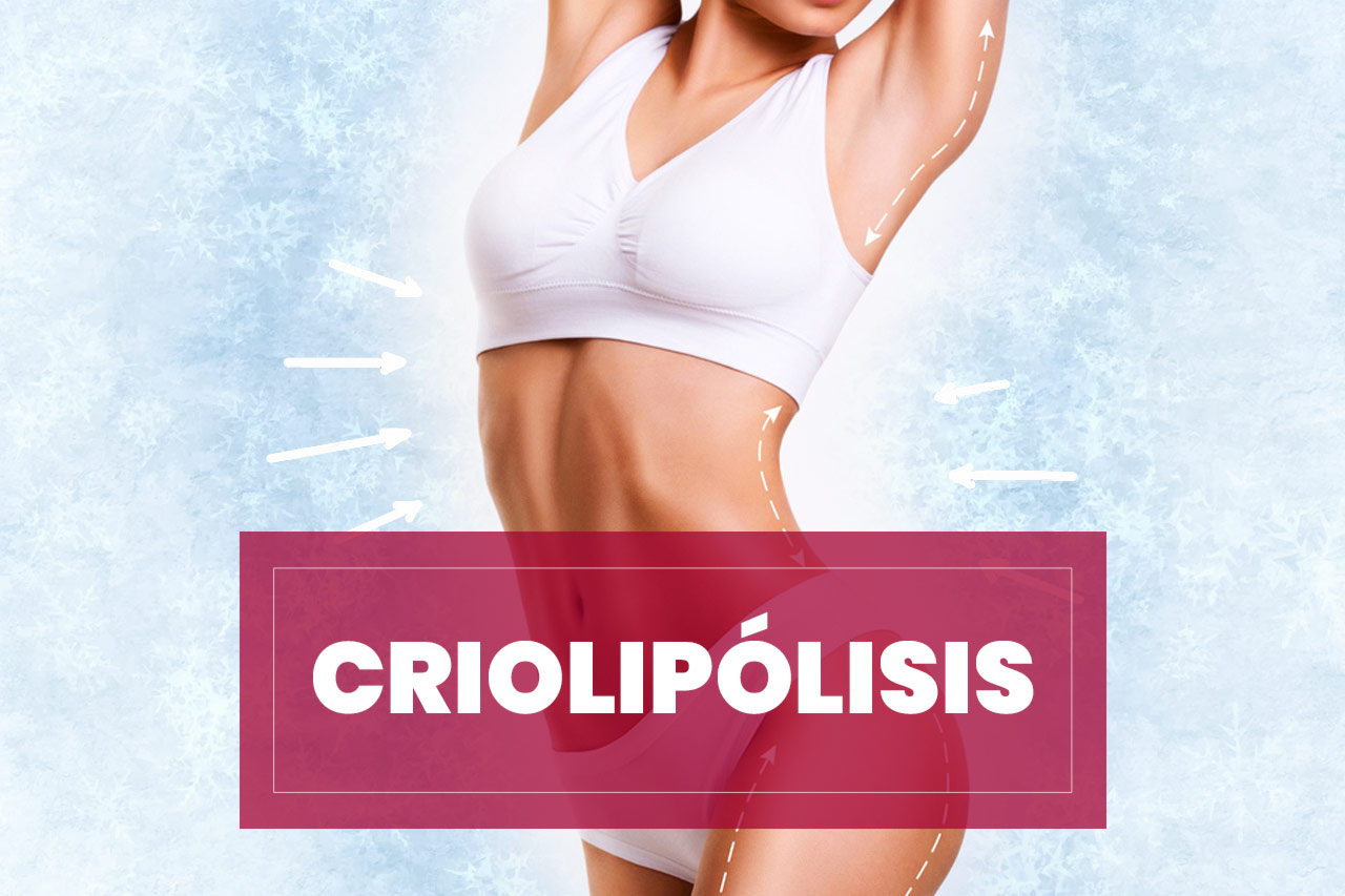 criolipolisis-destacada Criolipólisis (o crioadipólisis) un tratamiento que usa el frío para eliminar grasa localizada