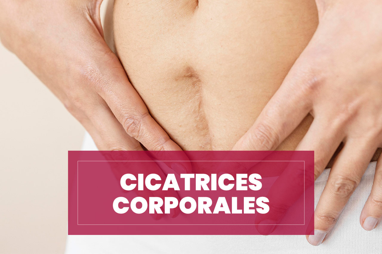 Tratamiento de Cicatrices Corporales