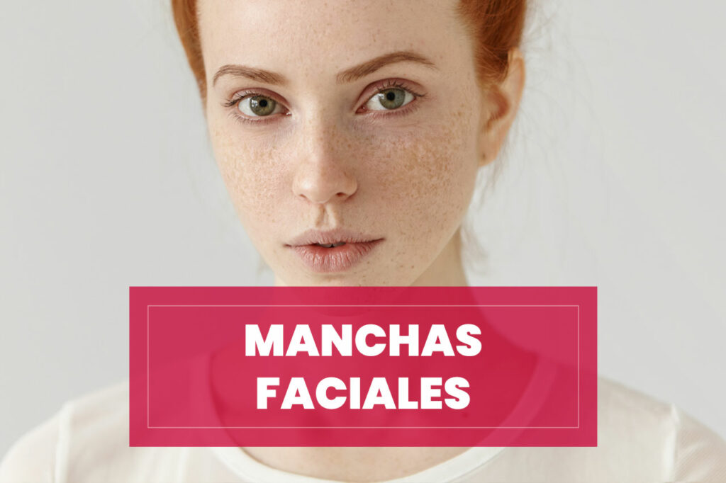 manchas-faciales Tratamiento Manchas Faciales