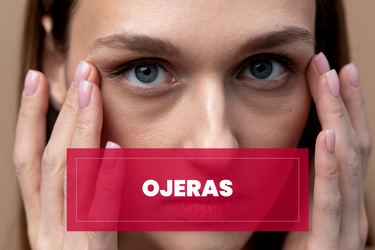 Tratamiento ojeras Tratamiento Ojeras