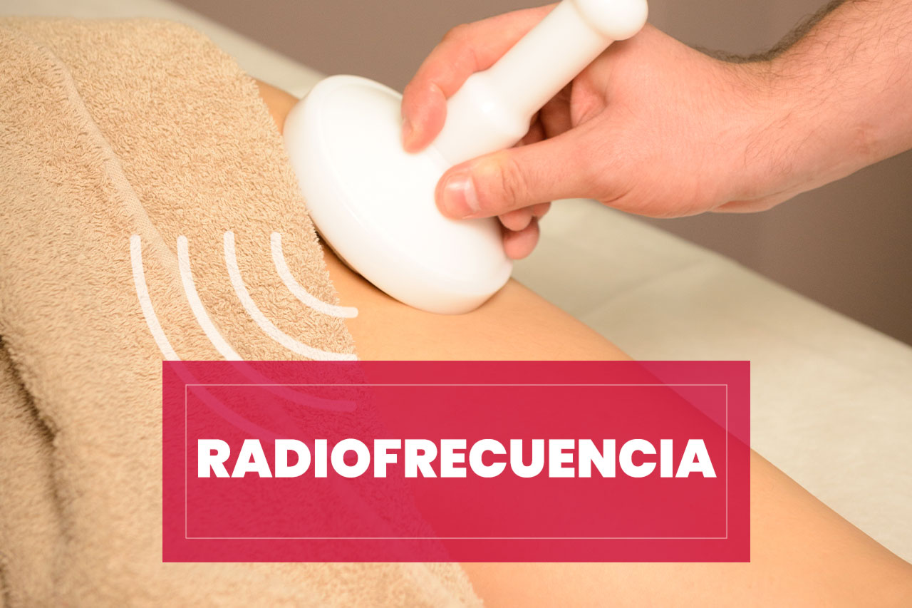 radiofrecuencia Tratamiento con Radiofrecuencia