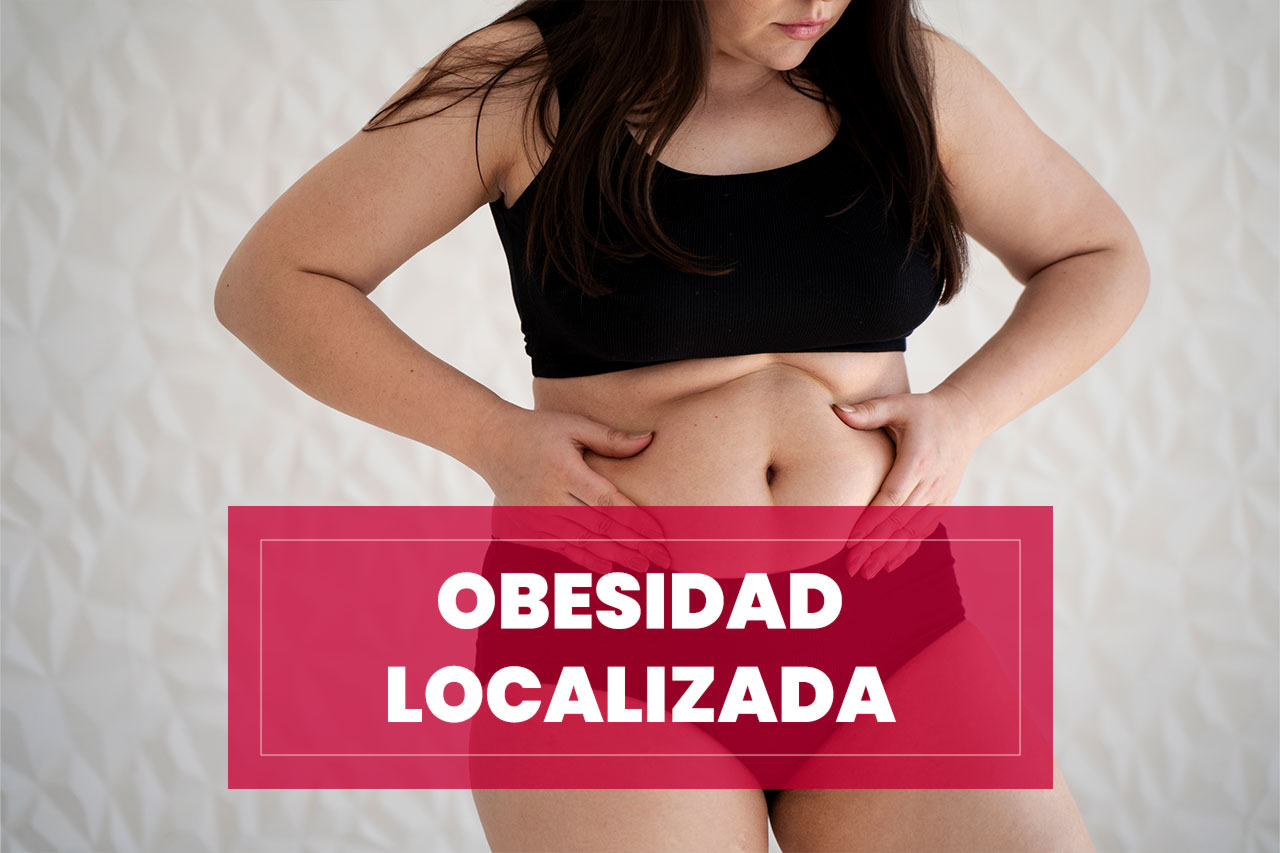 Tratamiento de Obesidad localizada Tratamiento de Obesidad localizada