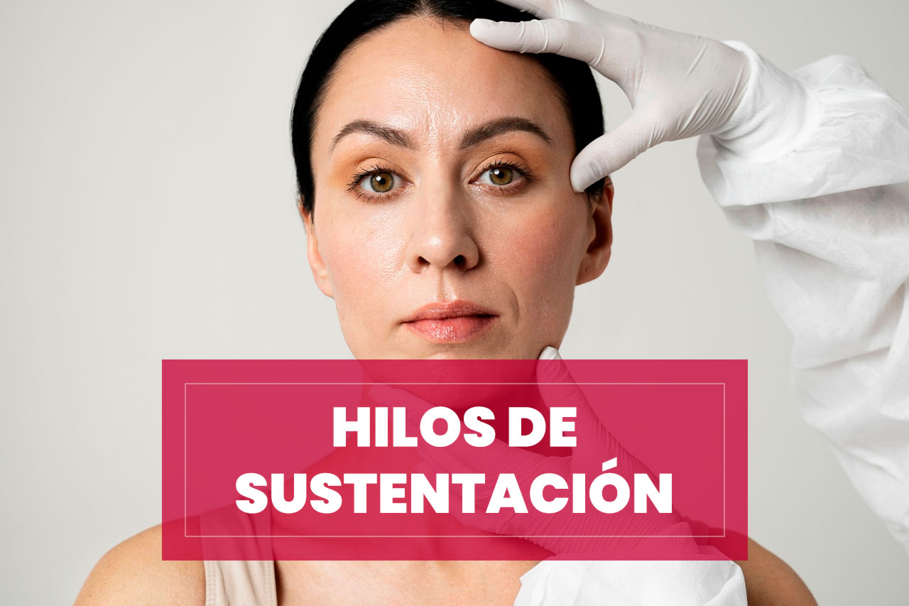 Tratamiento por Hilos de Sustentación