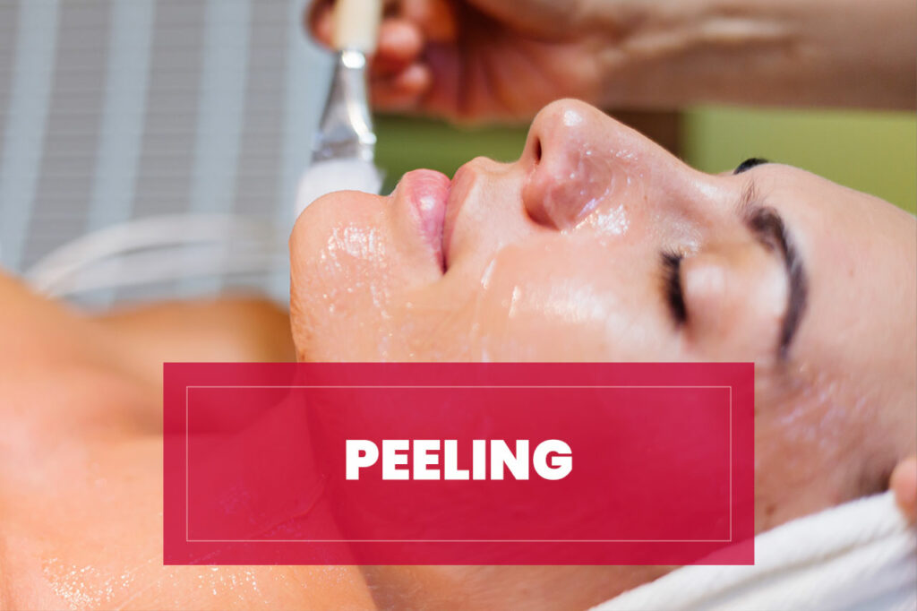 Tratamiento de Peeling