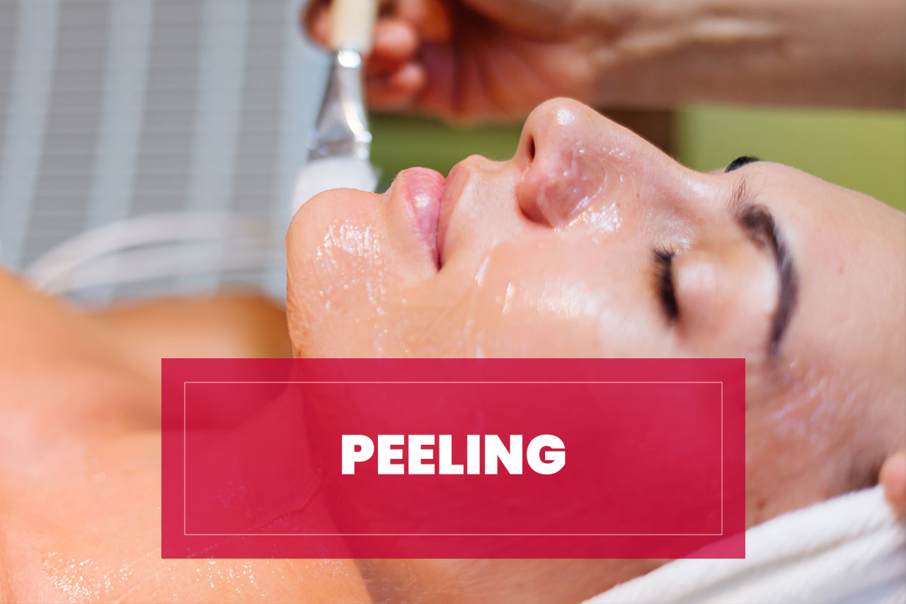 Tratamiento de Peeling Tratamiento de Peeling