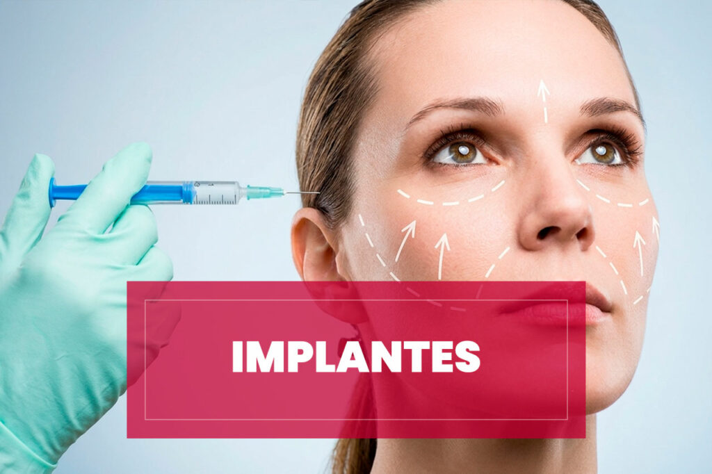 Tratamiento Implantes de Relleno